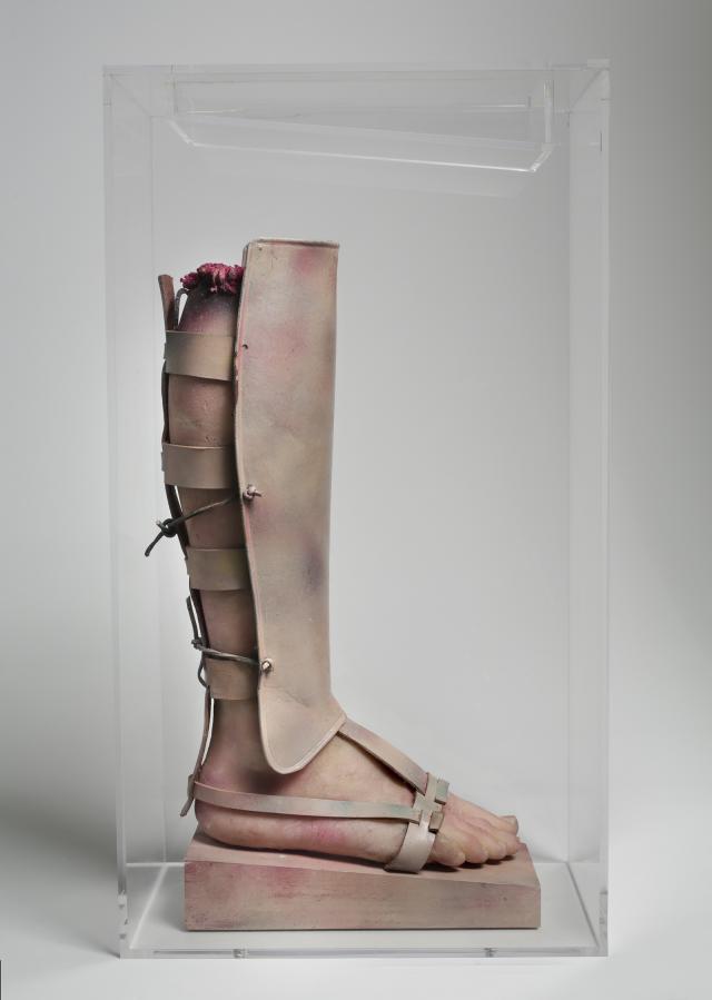 An image of a leg with a covering over it.